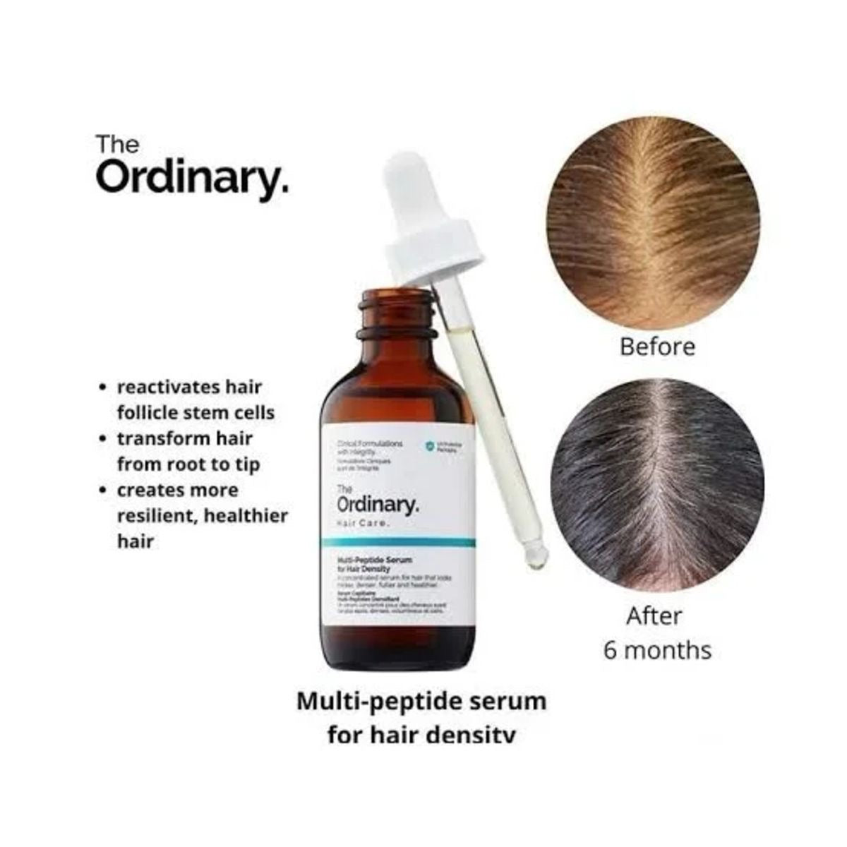 Multi-Peptide Serum for Hair Density