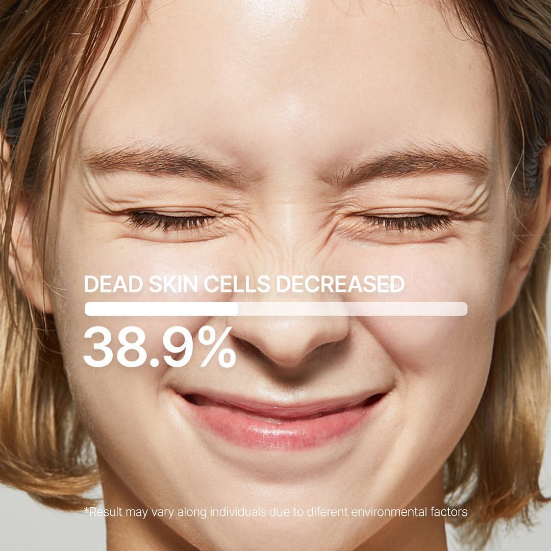 Red Acne Succinic Acid Peel Cleansing Booster