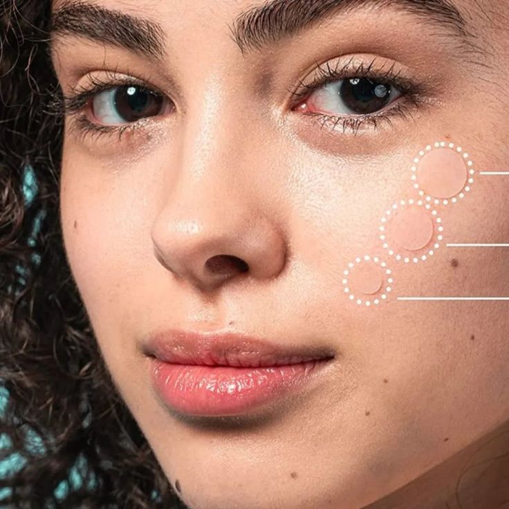 Acne Pimple Master Patch