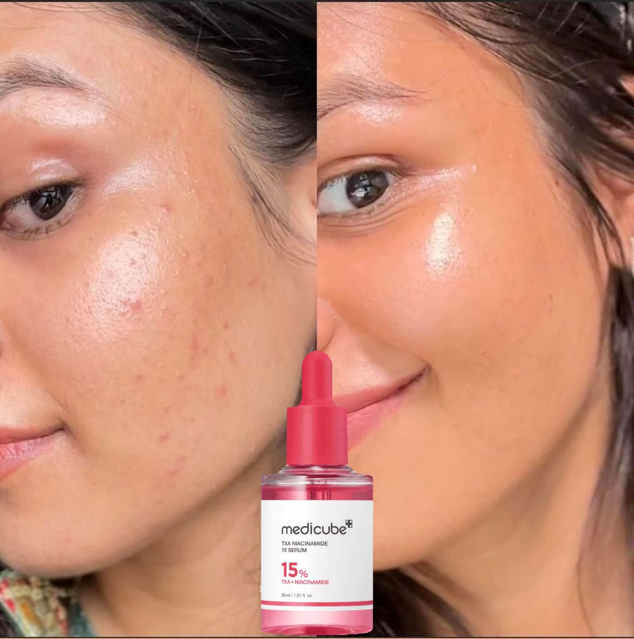TXA Niacinamide Serum
