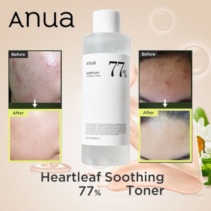 Heartleaf 77% Soothing Toner