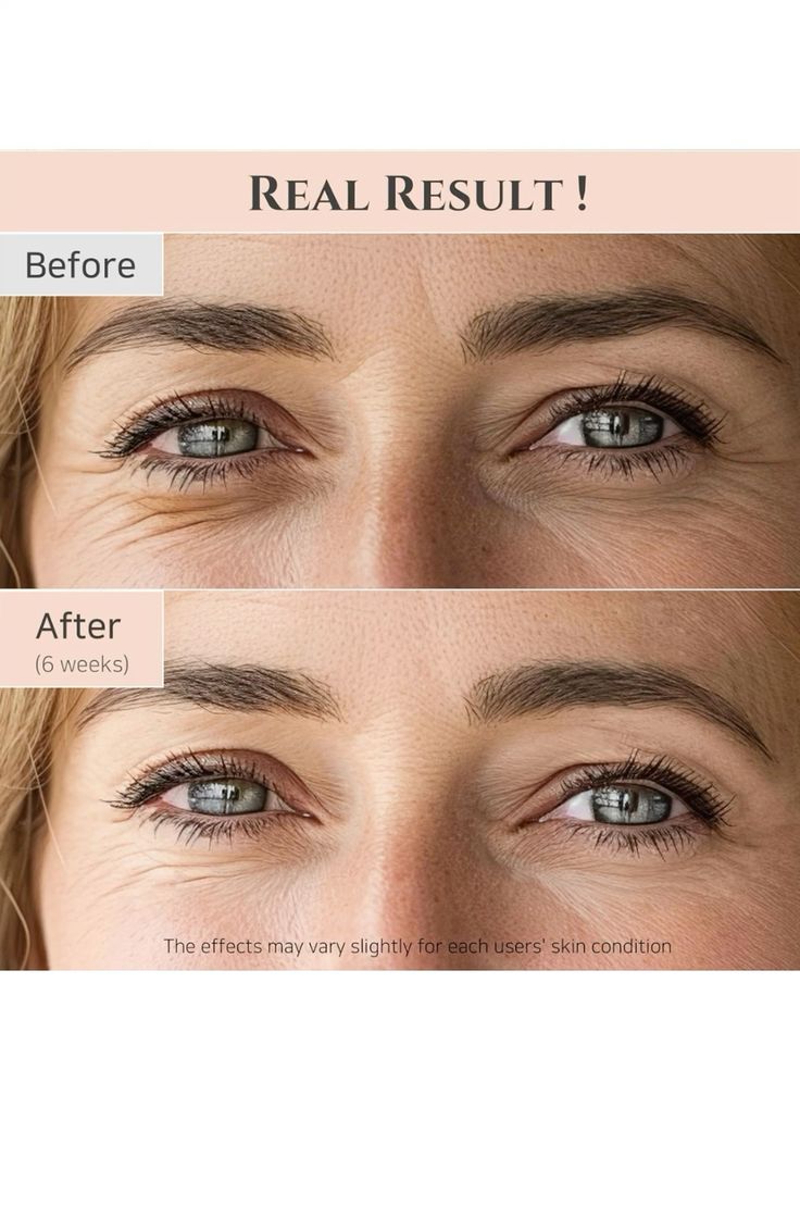 Revive Eye Serum : Ginseng + Retinal