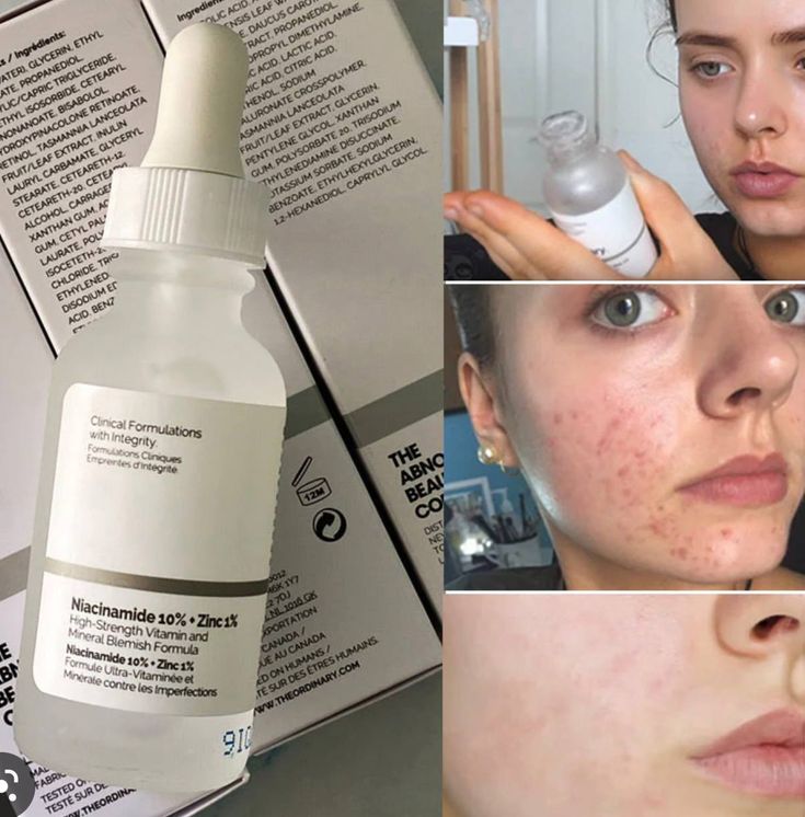 Niacinamide 10% + Zinc 1%